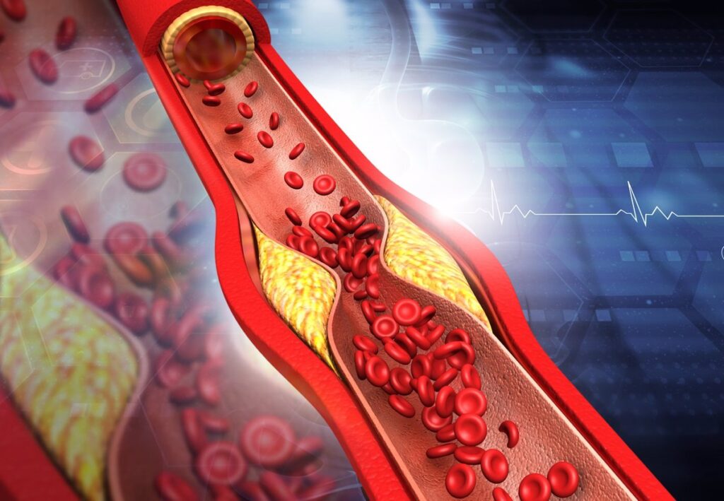 Alimentación saludable, ejercicio regular y no fumar: claves para reducir el colesterol LDL y mantener una buena salud cardiovascular