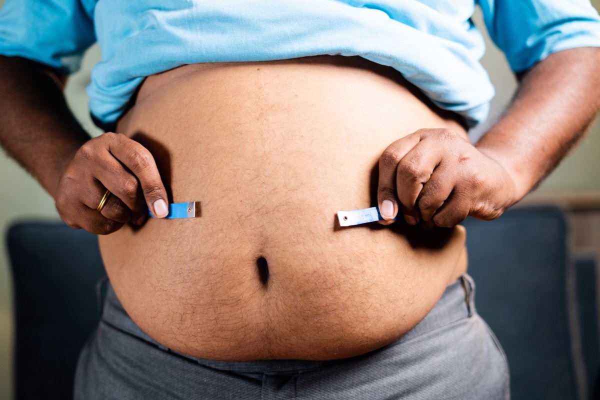 La circunferencia de la cintura está "íntimamente vinculada" con la mortalidad en pacientes con diabetes mellitus.