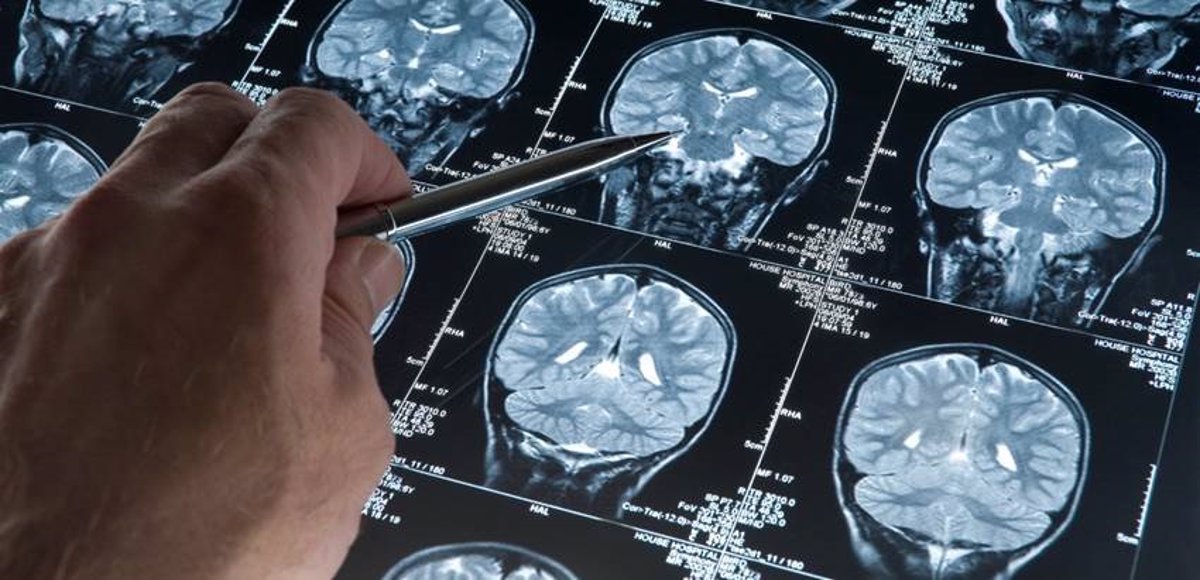 Descubren un mecanismo que ayuda a las células especializadas de las meninges a preservar la salud cerebral.