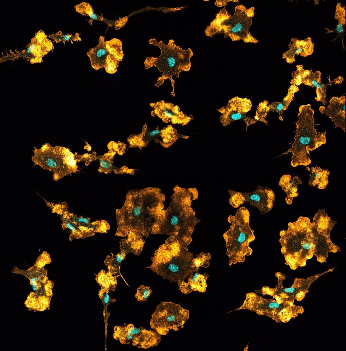 Los macrófagos obtienen nutrientes de las bacterias y virus que consumen.