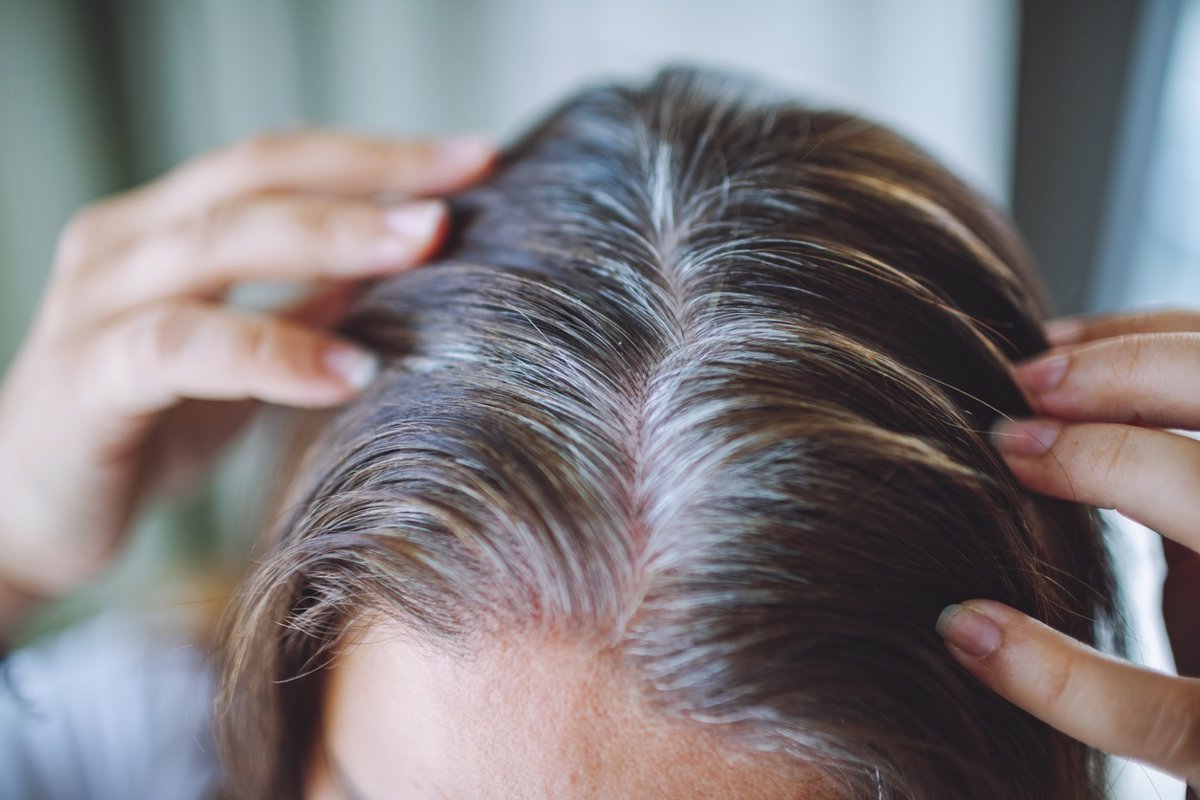 ¿Adiós a las canas? El secreto para prevenirlas podría encontrarse en el apio y el brócoli.