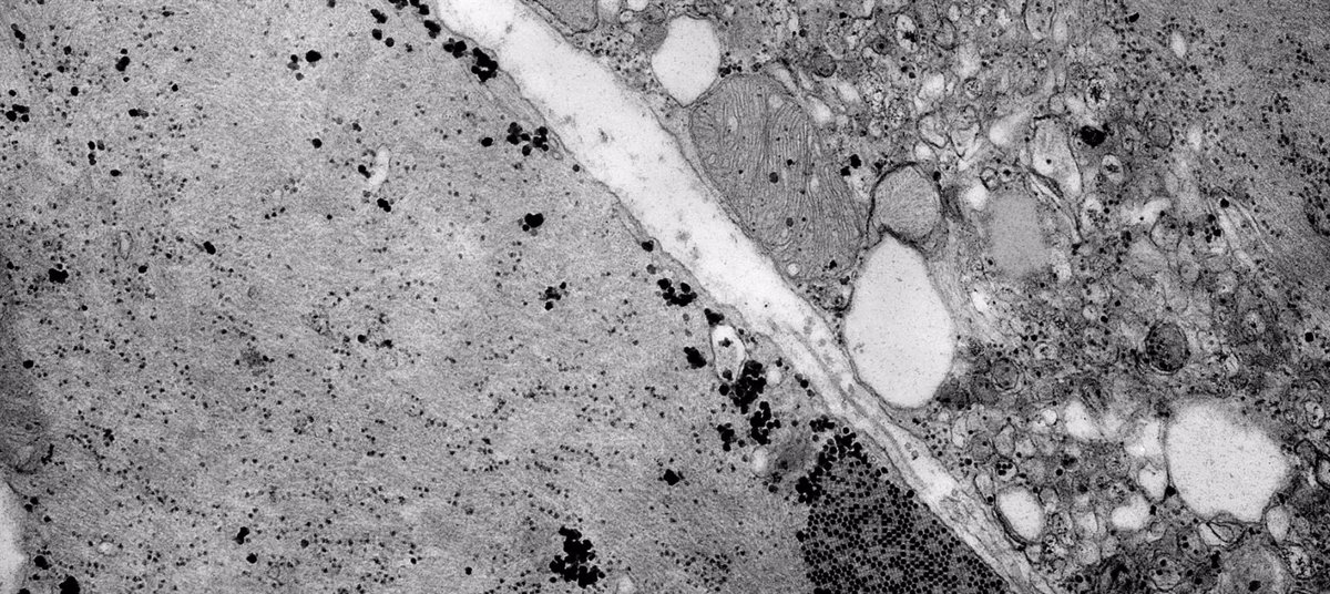 El ISCIII registra los primeros casos en España de un enterovirus poco común asociado a enfermedades respiratorias y neurológicas.