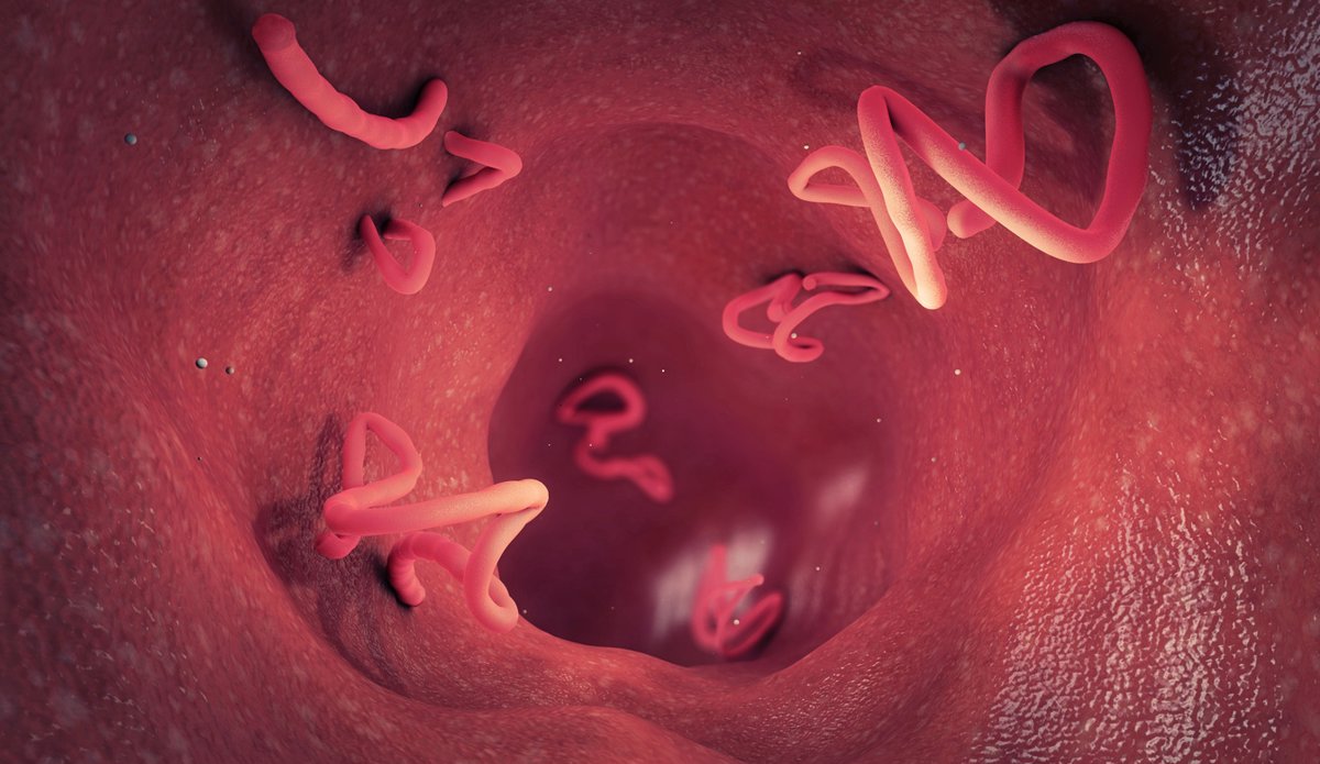 Un parásito común podría elevar el riesgo de cáncer cervical
