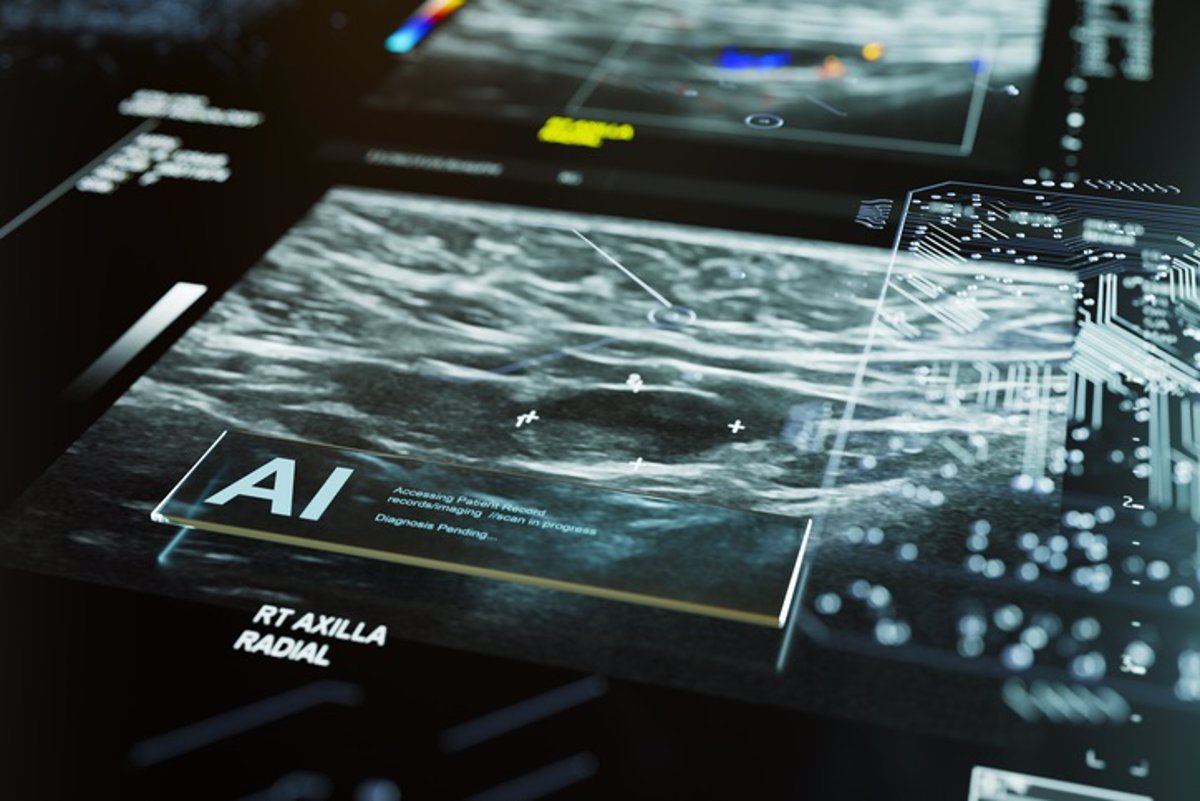 Biopsia Líquida: Una Alternativa Eficaz para Detectar Mutaciones en Cáncer de Mama HER2+