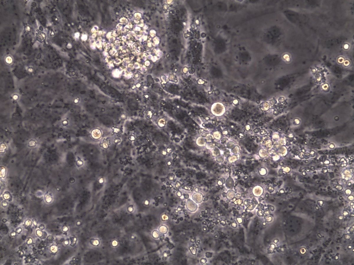 Investigación revela 7 genes clave para la producción eficiente de precursores de células sanguíneas