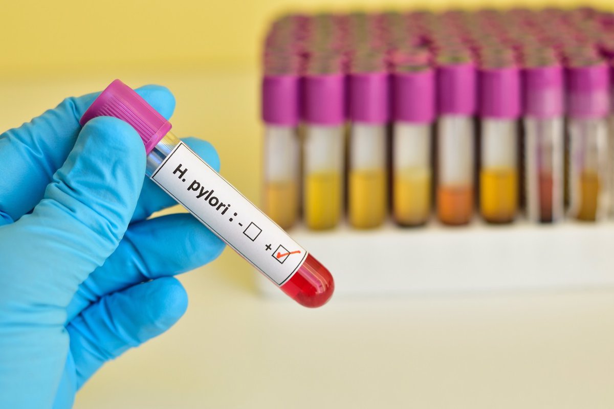 Desarrollan un biosensor nanofotónico para la detección rápida y precisa de 'Helicobacter pylori' sin necesidad de marcadores.