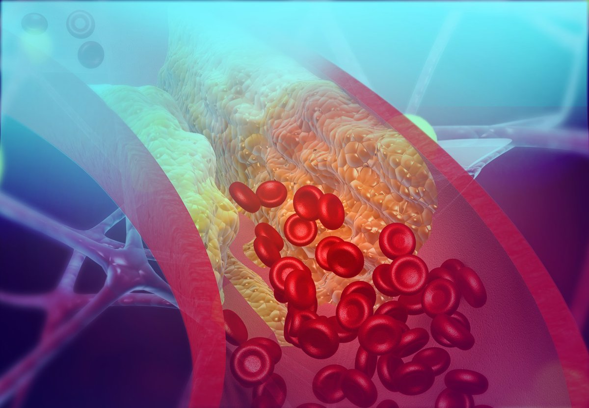 Investigadores españoles desarrollan una innovadora estrategia para reducir los niveles de colesterol en sangre.