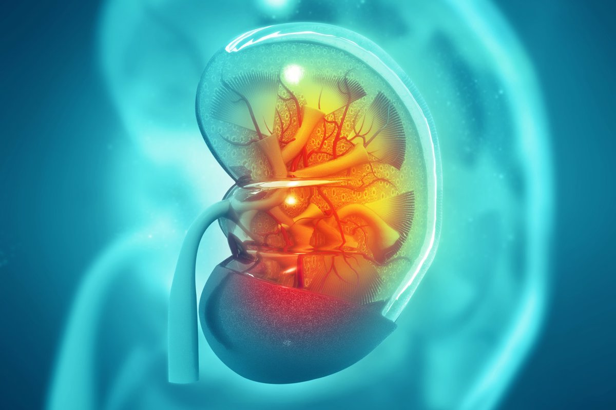 La SEOM prevé cerca de 10,000 nuevos casos de cáncer de riñón en 2025, convirtiéndose en el octavo tumor más común en España.