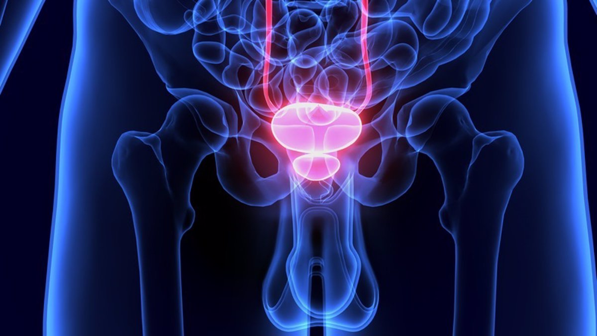 Los avances terapéuticos multiplican por tres la supervivencia de pacientes con cáncer de próstata avanzado en 15 años.
