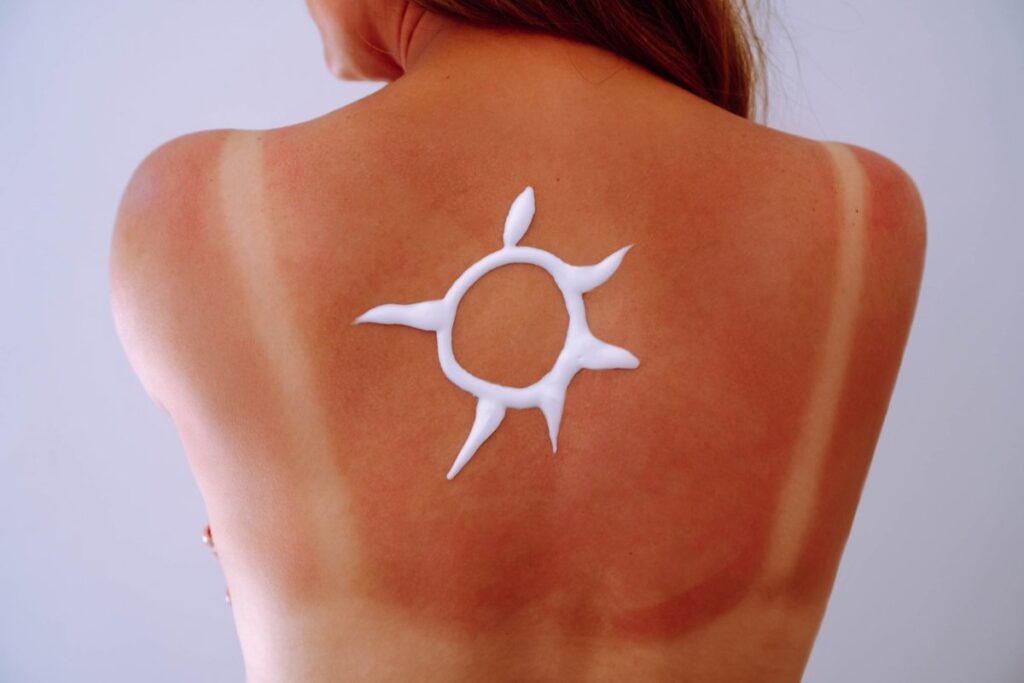 ¿Por qué algunas personas se broncean y otras se queman? 5 datos sorprendentes sobre la exposición al sol.