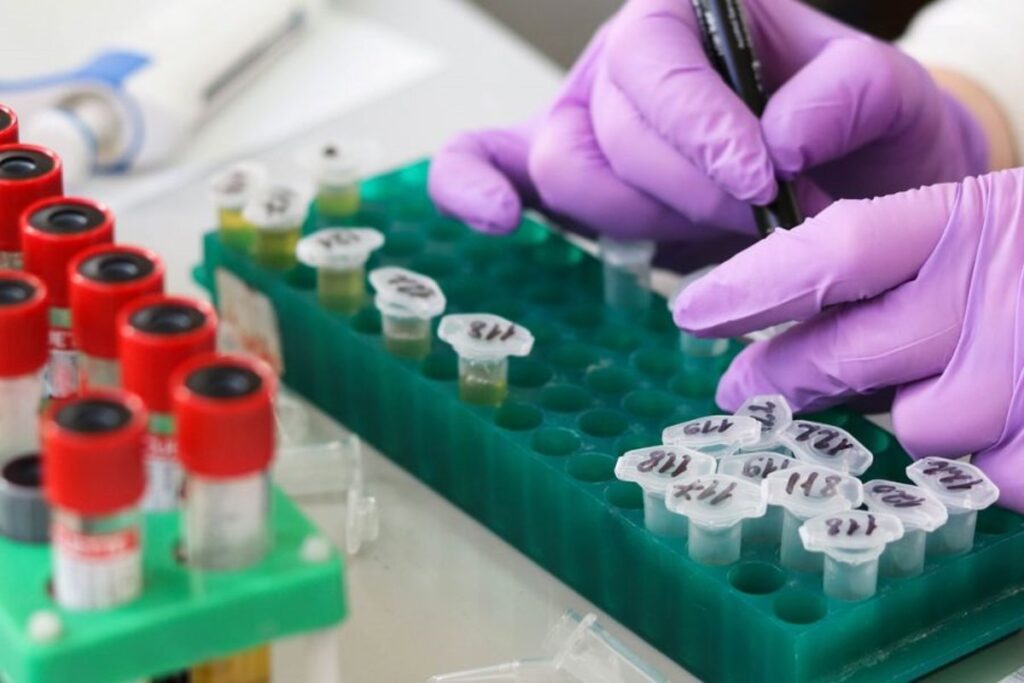 Descubren biomarcadores sanguíneos que predicen la diabetes tipo 2 hasta siete años antes del diagnóstico.