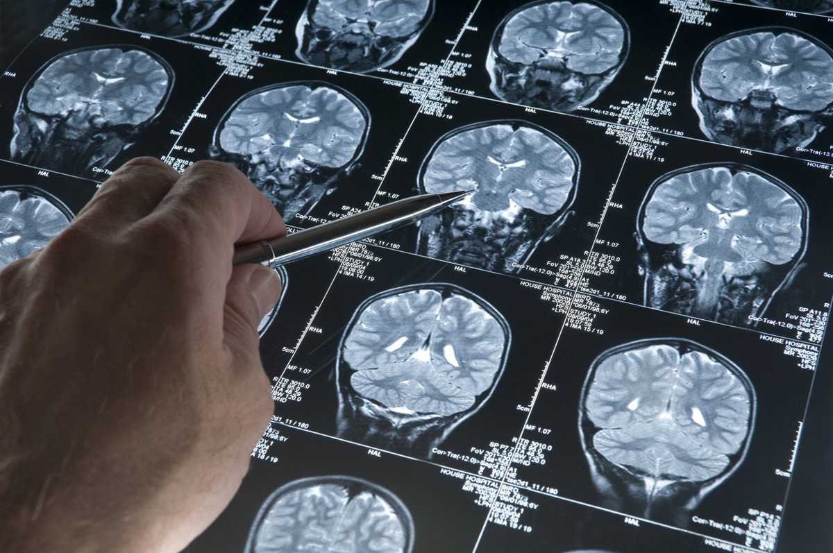 El Consejo Español del Cerebro llama a adoptar políticas integrales para la salud cerebral.