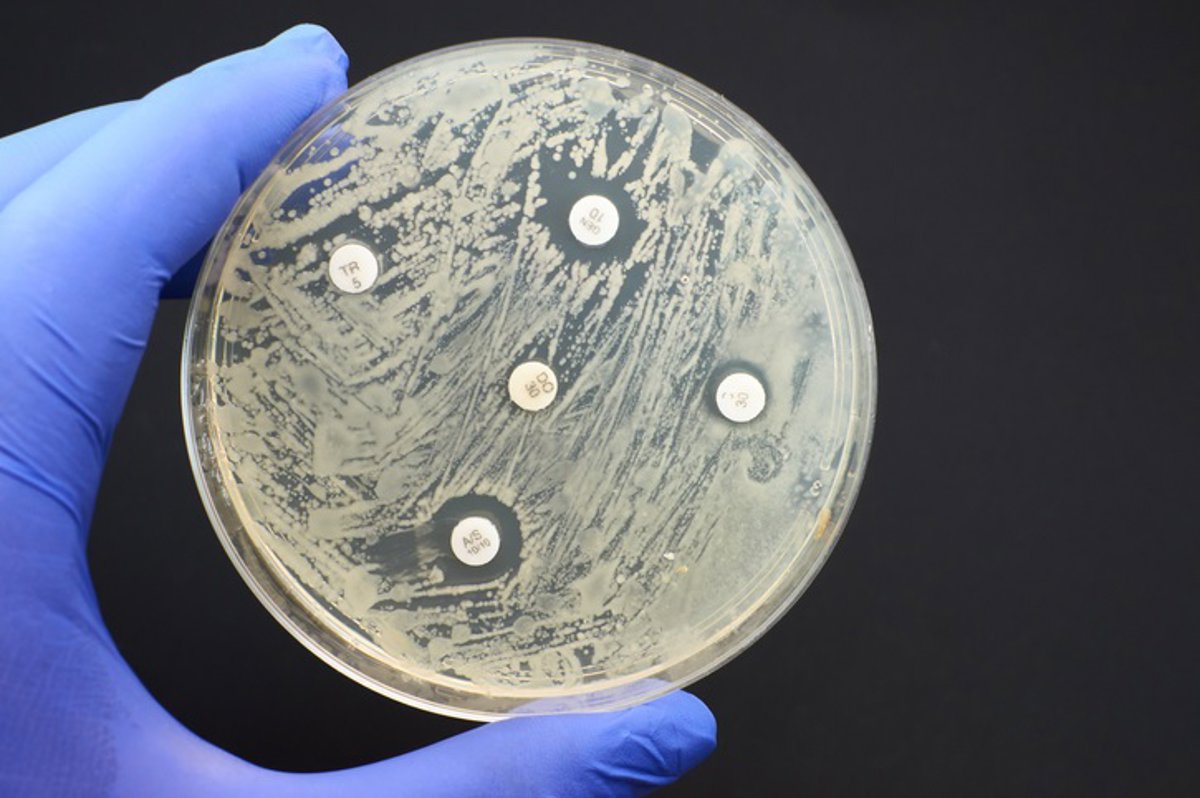 Sanidad cierra esta semana la consulta del RD para regular el Plan Estratégico contra la resistencia a los antimicrobianos.