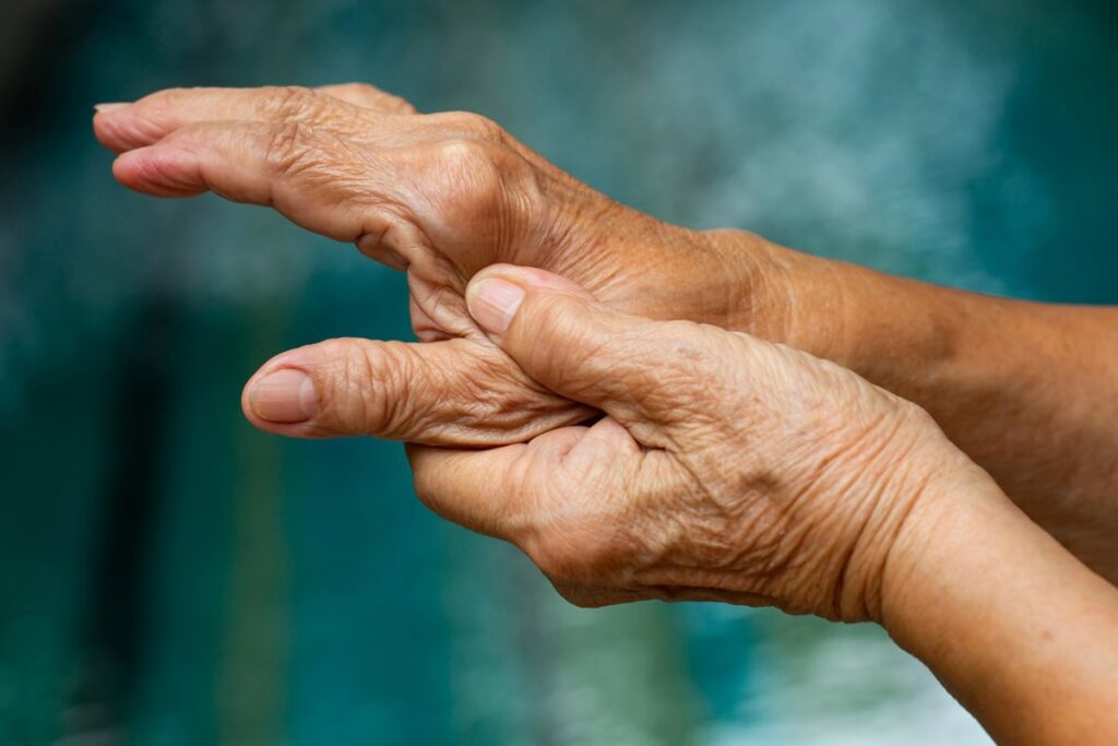 ¿Es efectiva la cirugía para tratar la artrosis de la mano? "Facilita la recuperación de la funcionalidad"