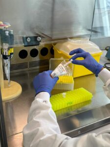 Crean el primer biomarcador en sangre que predice la progresión hacia el Alzheimer