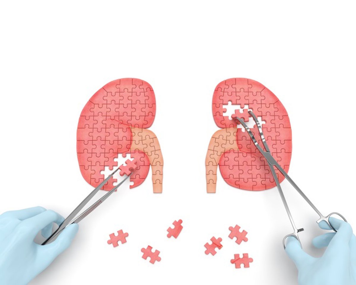 Enfermedad renal: la falta de vitamina D activa y sus efectos en anemia y problemas óseos