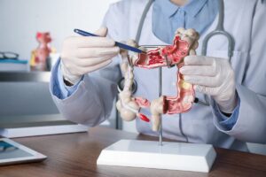 Los factores que causan el cáncer colorrectal de aparición temprana podrían tener su origen en la infancia, según un estudio.