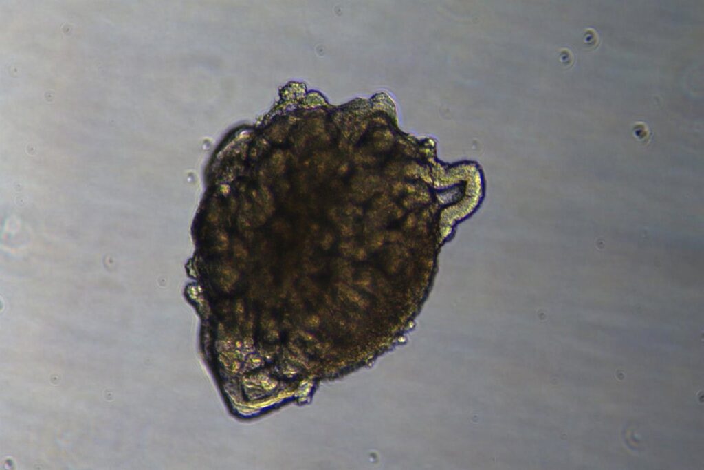 Realizan el primer trasplante de riñones modificados en un cerdo utilizando organoides renales humanos.