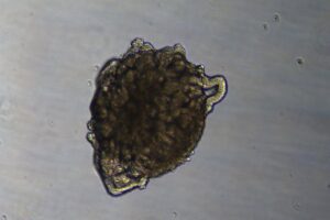 Realizan el primer trasplante de riñones modificados en un cerdo utilizando organoides renales humanos.