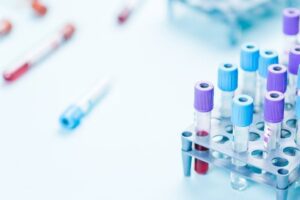 Técnicos Superiores Sanitarios convocan huelga de cuatro días: 30 y 31 de octubre, y 3 y 4 de noviembre.
