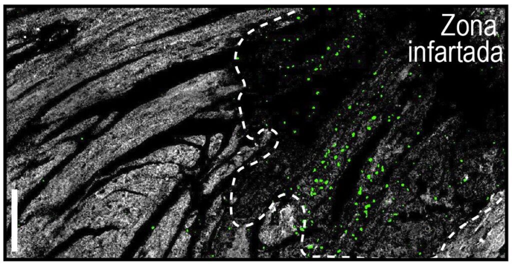 ¿Por qué los infartos nocturnos son menos severos? Un estudio del CNIC destaca el papel de los ritmos circadianos de los neutrófilos.
