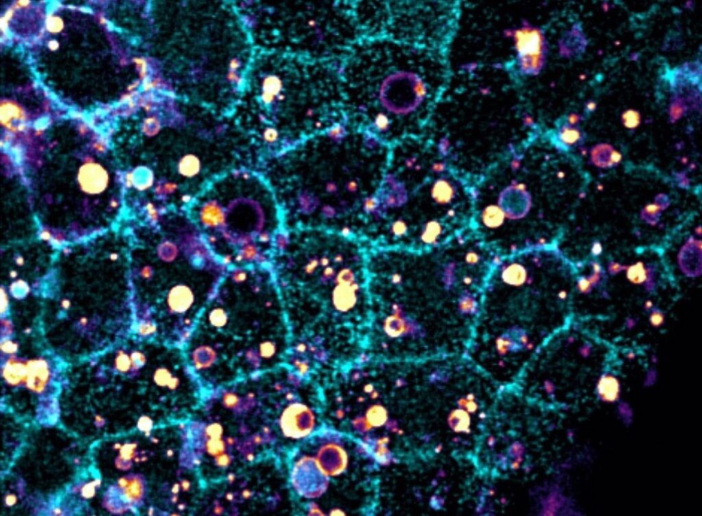Identifican el mecanismo mediante el cual las células "descomponen" y eliminan células muertas.